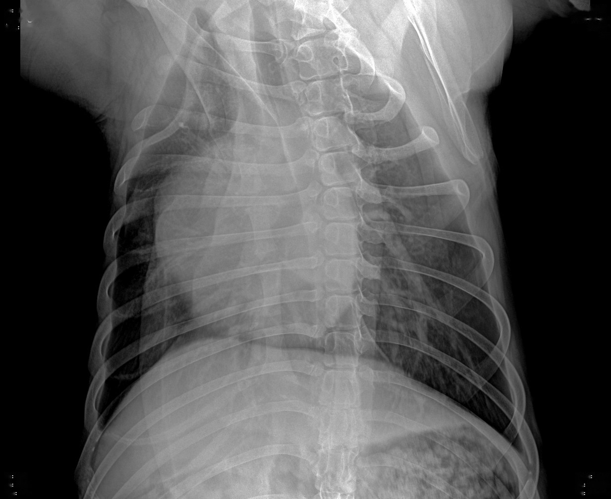 Image after multi-scale enhancement