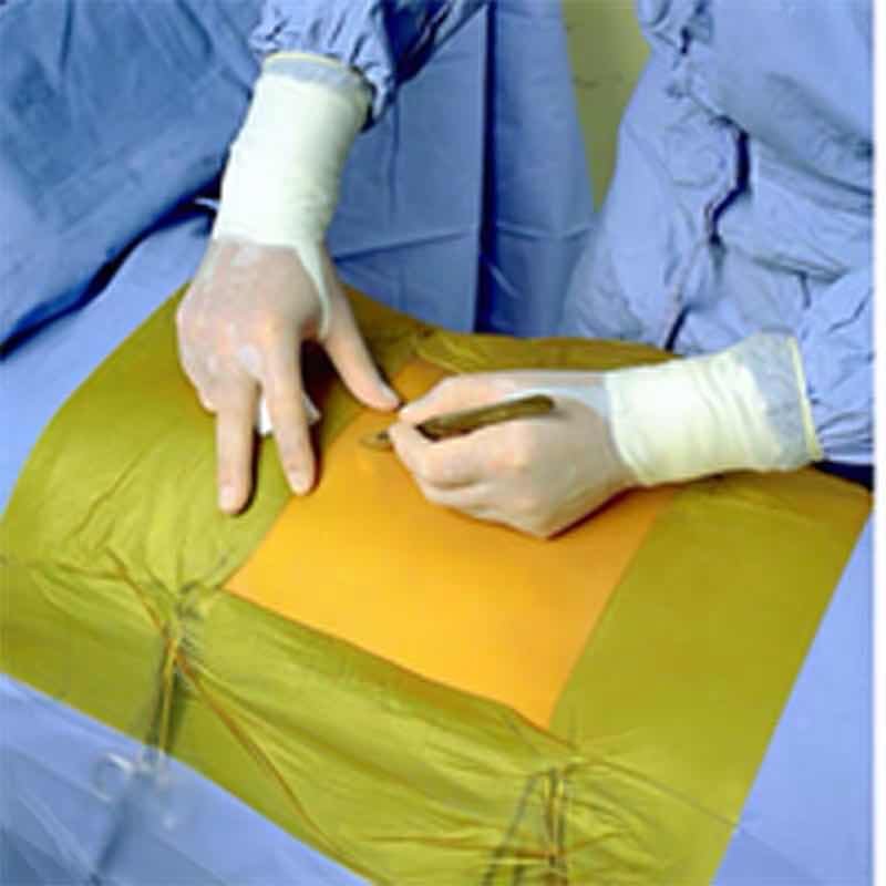 Antibacterial Iodophor-containing Surgical Drape for Animal Operations | IWA Medical Veterinary Equipment Supplier