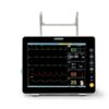 IWA-VM01 8-inch Veterinary Multi-parameter Monitor
