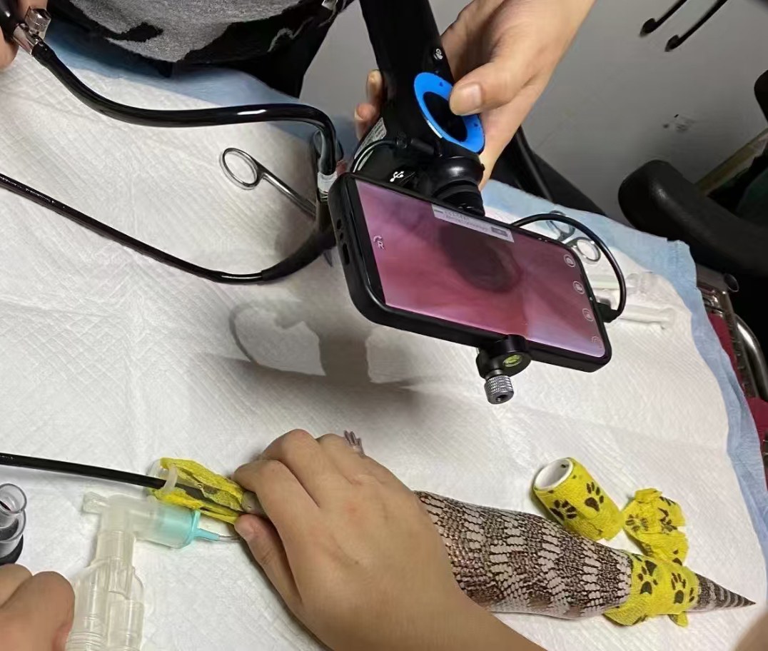IWA-HD3 in clinical use