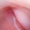 SOAIM SA Series — sample endoscopic mucosal image demonst... SOAIM SA Series — sample endoscopic mucosal image demonstrating high-definition clarity in gastrointestinal examination