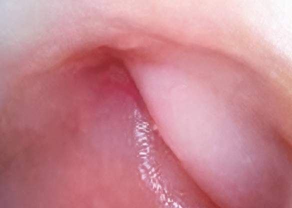 SOAIM SA Series — sample endoscopic mucosal image demonst... SOAIM SA Series — sample endoscopic mucosal image demonstrating high-definition clarity in gastrointestinal examination