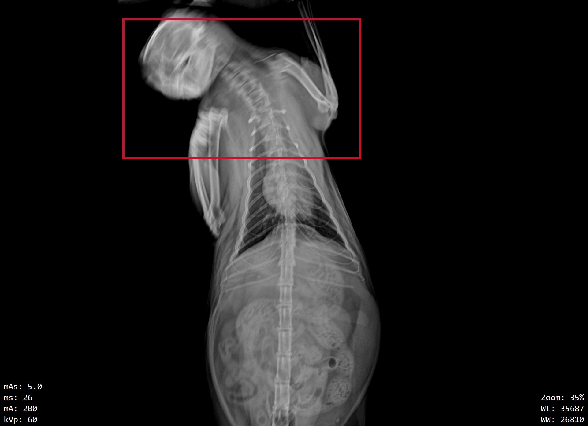 Full radiograph with motion blur; a red box marks the doubled head and neck region