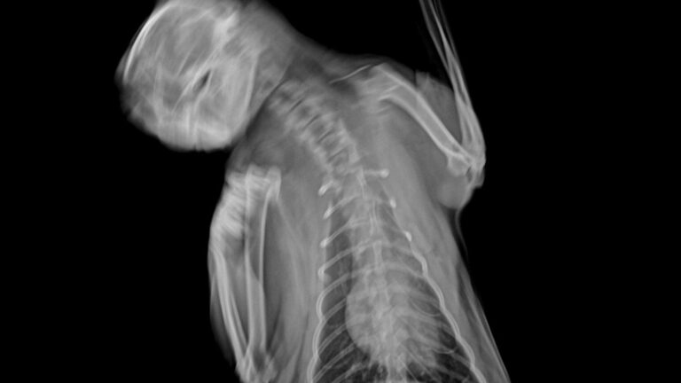 Lateral radiograph showing motion blur