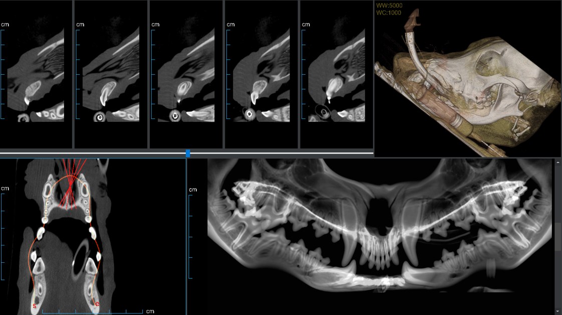 Dental panoramic reconstruction with cross-sectional views
