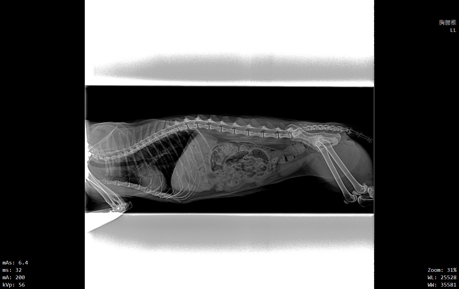 Same region collimated tight: the collimation edge is clearly visible, contrast improved (de-identified)