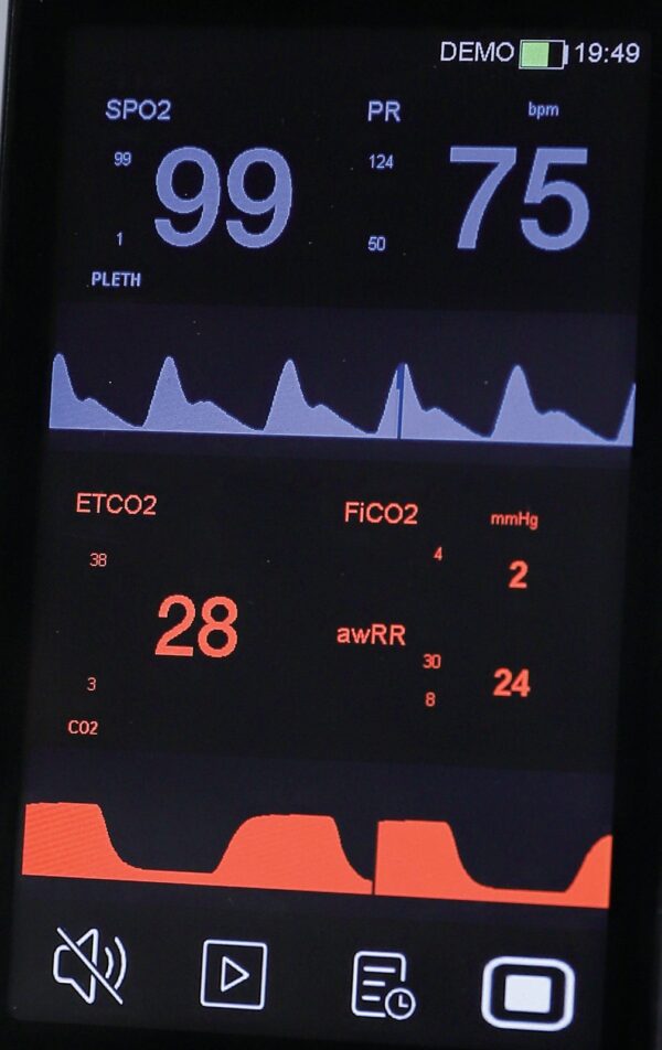 VE4 4-inch display close-up - SpO2 and PR values with plethysmogram, ETCO2, FiCO2 and airway respiration rate with capnogram