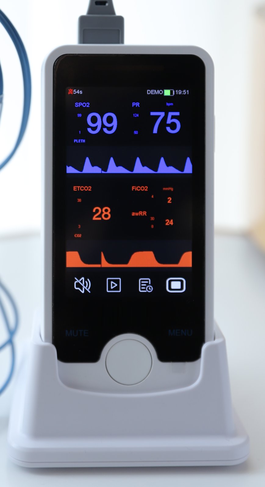 VE4 vital signs monitor docked in its charging base with the SpO2 sensor cable connected